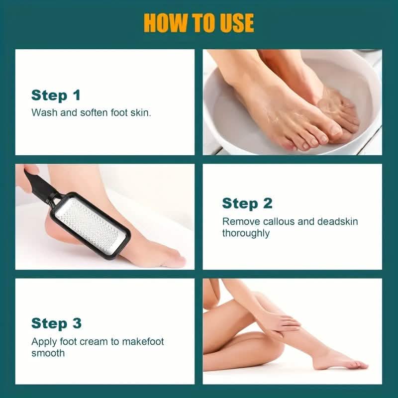 4-Piece Stainless Steel Foot File Set – Callus &amp; Dead Skin Remover